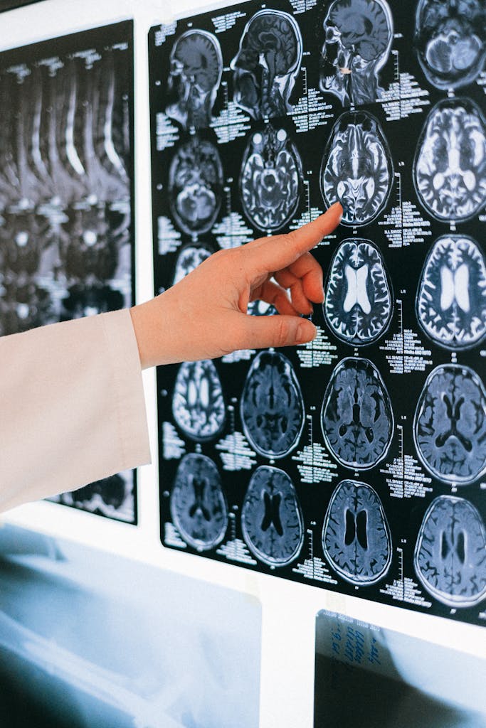 A doctor's hand points to a brain MRI scan on a lightbox, illustrating medical diagnosis.