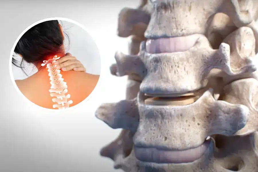 cervical artificial disc for a neck condition