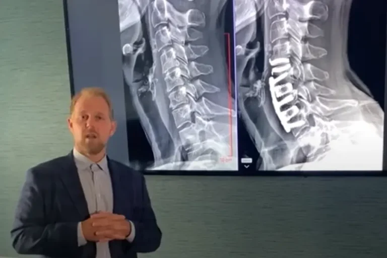 crg explains hybrid spine surgery