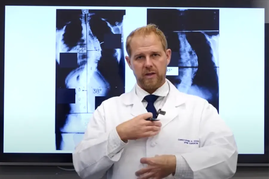 dr. good explains adult scoliosis