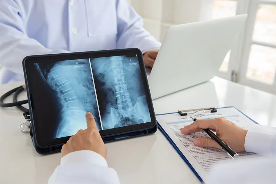 lumbar vertebrae x ray